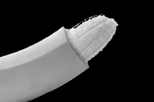 Fimose em crianças: quando tratar e quando operar?